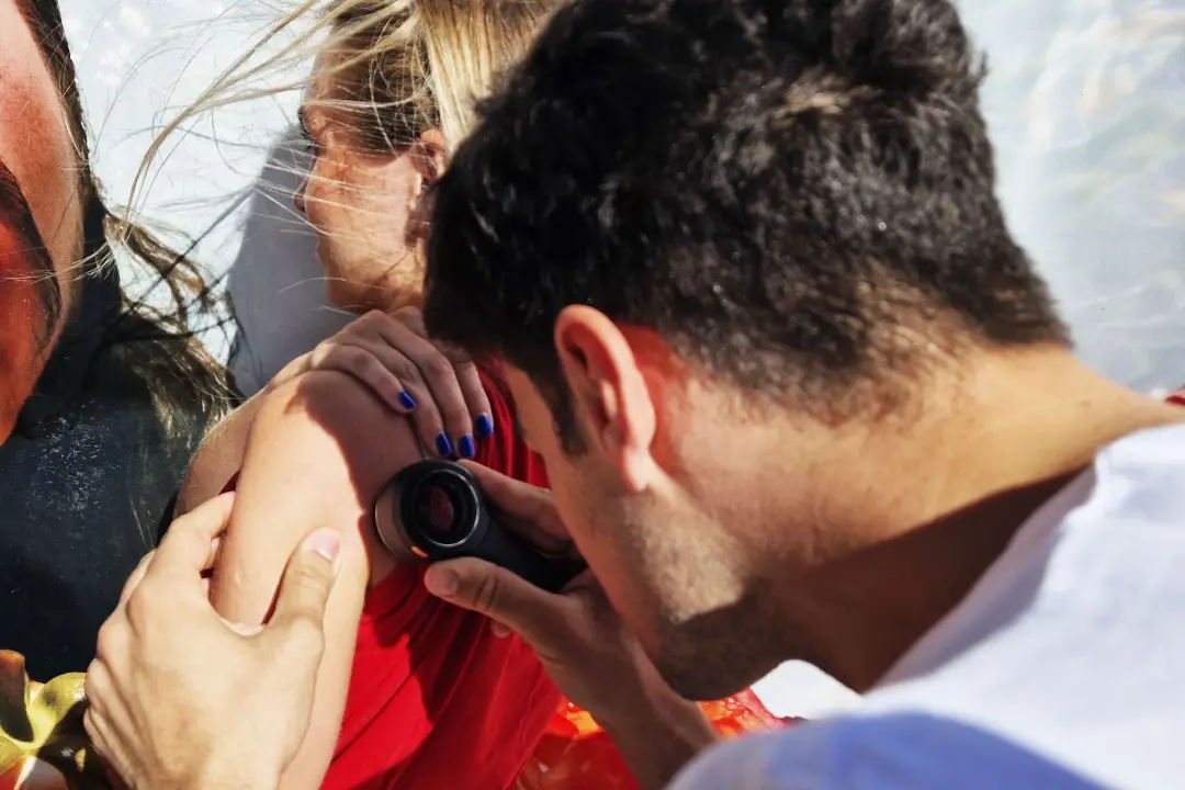 Na plaži Banj u Šibeniku 183 građana pregledalo madeže, 33 upućeno na daljnje preglede 