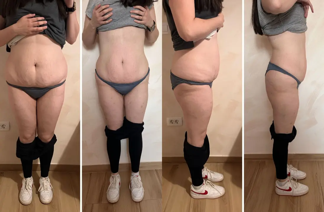 FOTO Skinite do 10 kilograma u 6 tjedana uz Beauty Clinic by Tamara