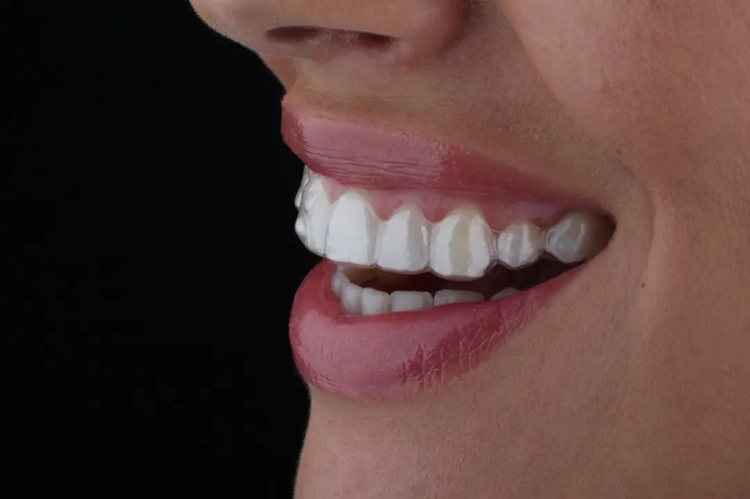 FOTO Transformirajte osmijeh prozirnim alignerima u Dental centru Dubravica! 	